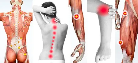 12 CE Hour Trigger Point & Neuromuscular Therapy Basics (Computer-Based Live Interactive Webinar)