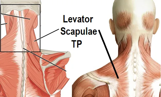 12 CE Hour Trigger Point & Neuromuscular Therapy Basics (Computer-Based Live Interactive Webinar)