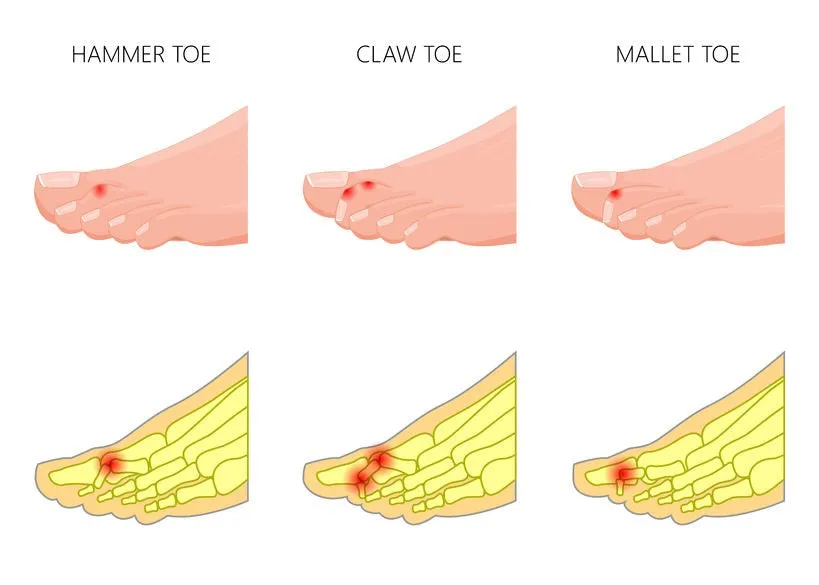 24 CE FL LMT Renewal Home Study Package Active Assisted LOWER Body Stretching (AAS) & Advanced Medical Foot Massage with Medical Massage Training Elective