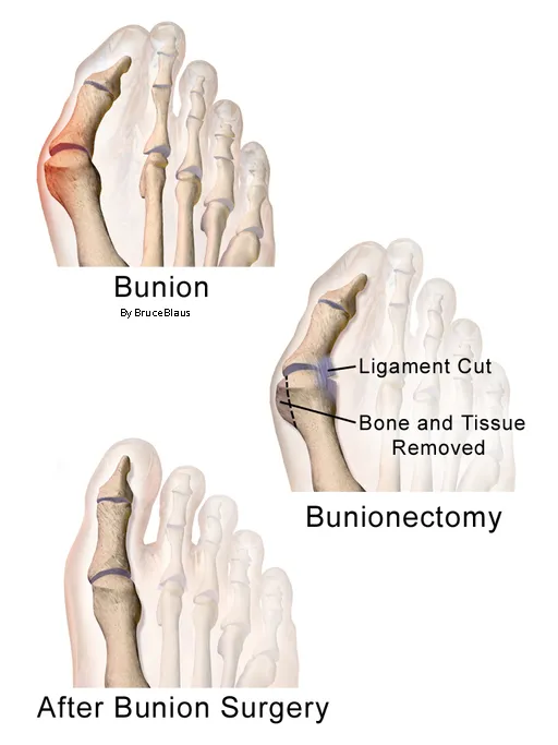 24 CE FL LMT Renewal Home Study Package Active Assisted LOWER Body Stretching (AAS) & Advanced Medical Foot Massage with Medical Massage Training Elective