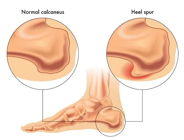 24 CE FL LMT Renewal Home Study Package Active Assisted LOWER Body Stretching (AAS) & Advanced Medical Foot Massage with Sanitation Training Elective