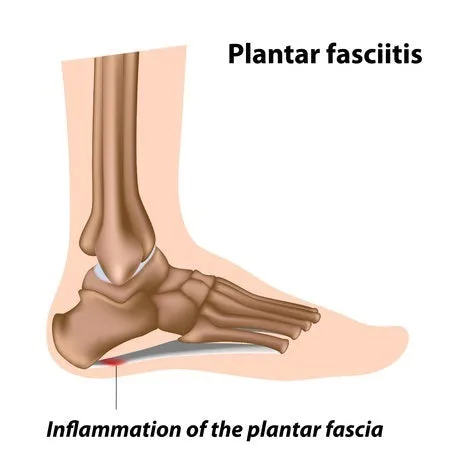 24 CE FL LMT Renewal Home Study Package Active Assisted LOWER Body Stretching (AAS) & Advanced Medical Foot Massage with Sanitation Training Elective