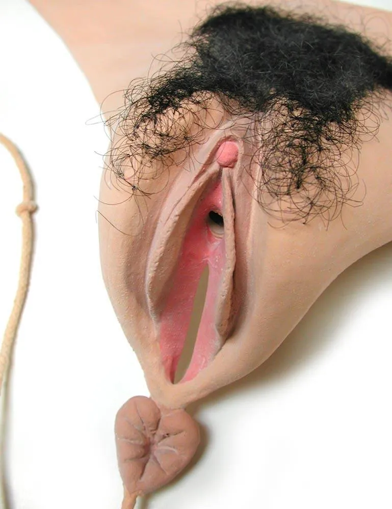 Bladder Vee-String Vagina Prosthesis